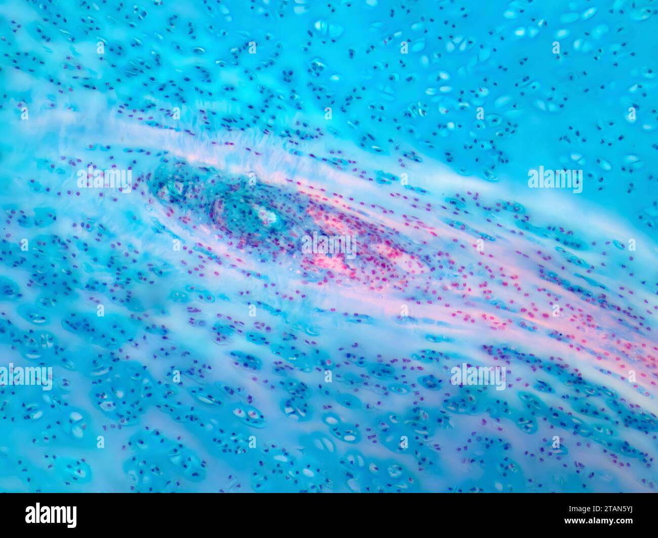 Cartilagine ialina umana, micrografia leggera Foto Stock