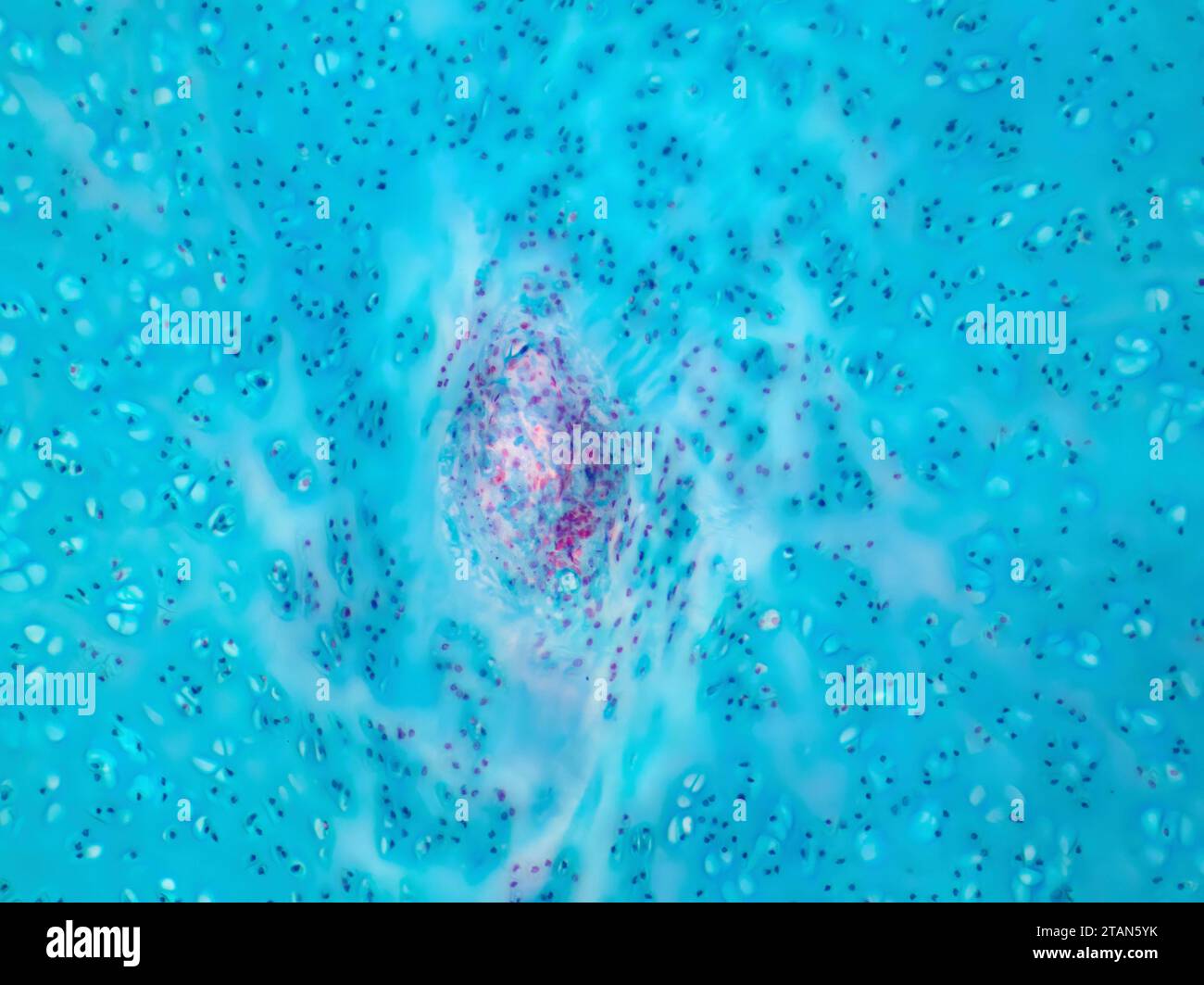 Cartilagine ialina umana, micrografia leggera. Foto Stock