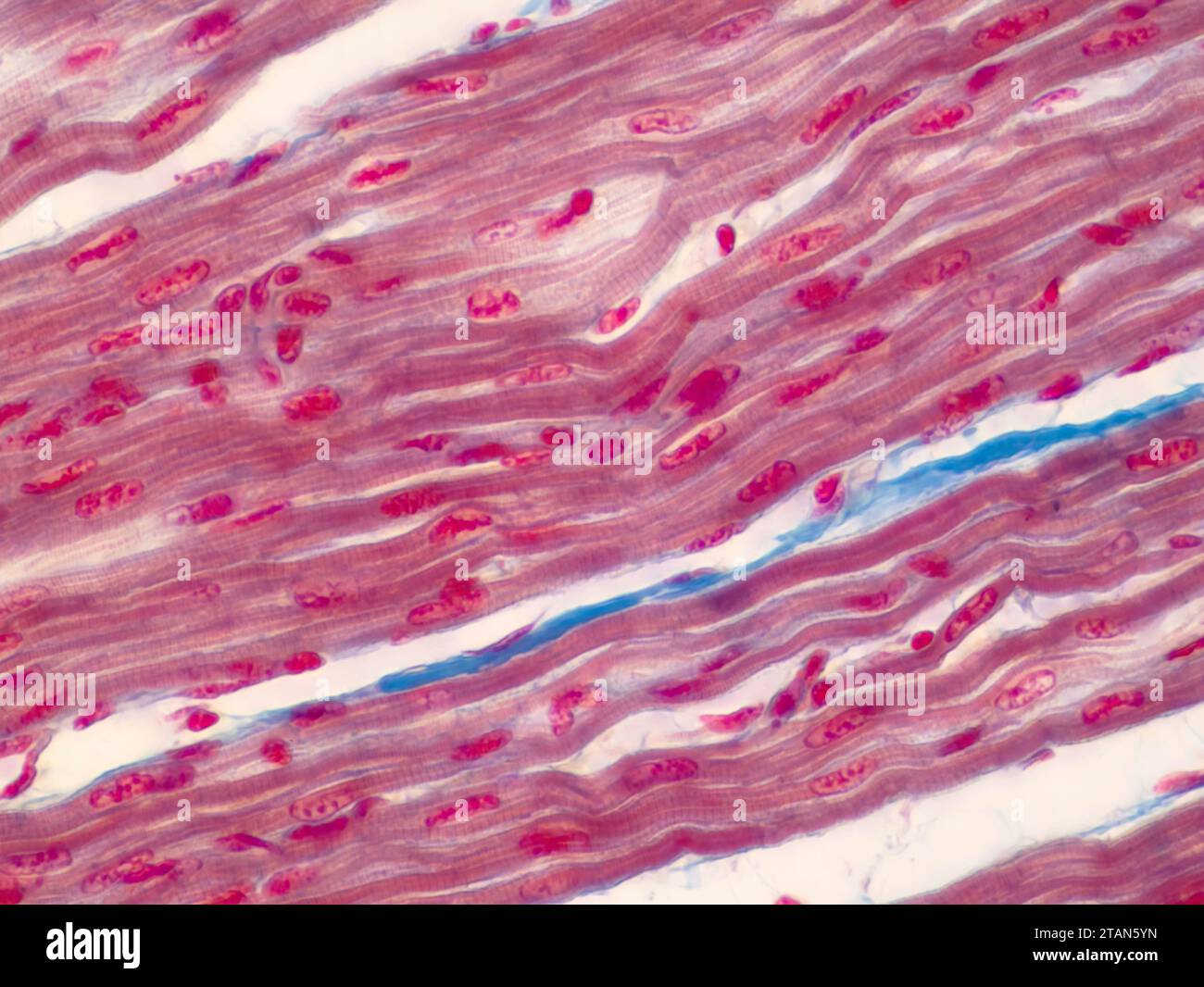 Muscolo cardiaco umano, micrografia leggera Foto Stock