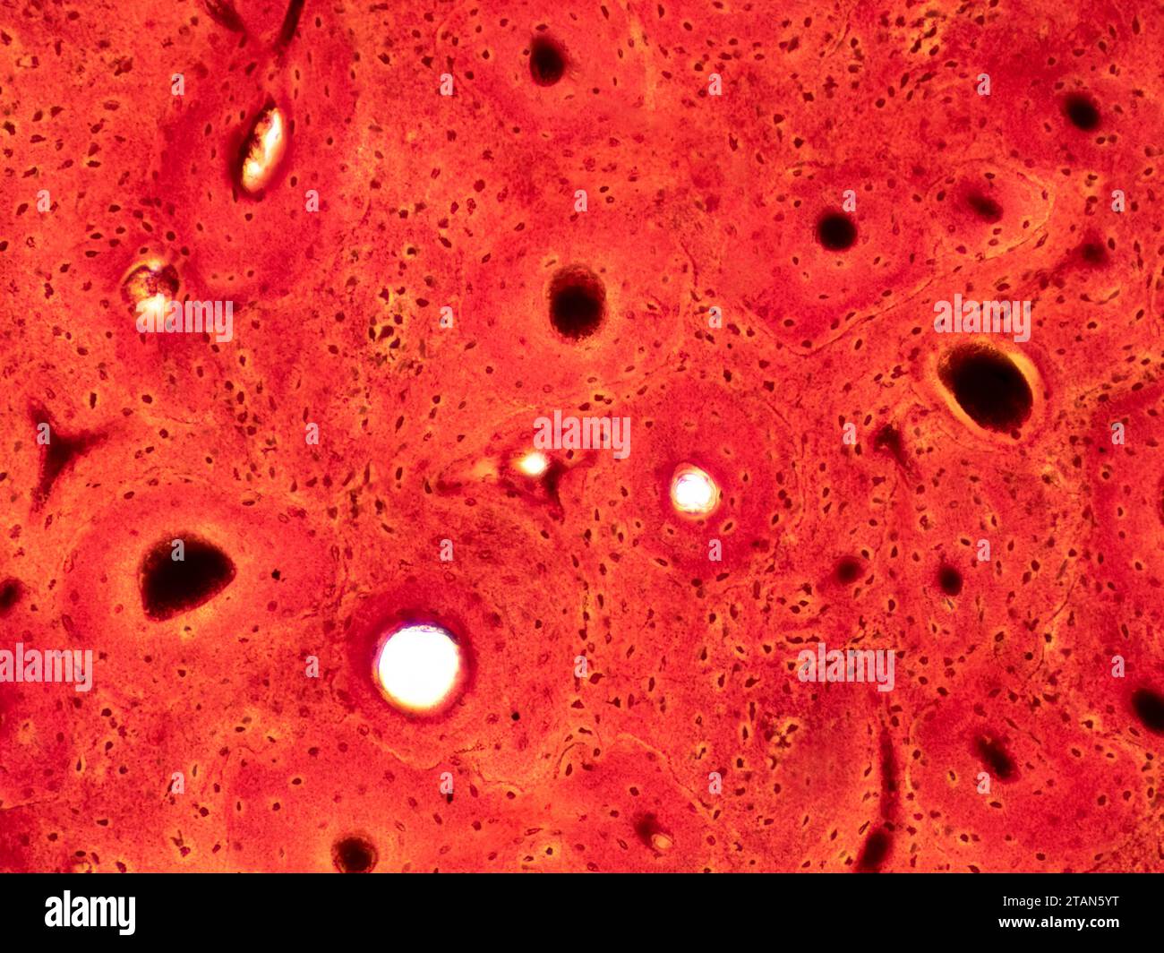 Tessuto osseo compatto umano, micrografia leggera Foto Stock