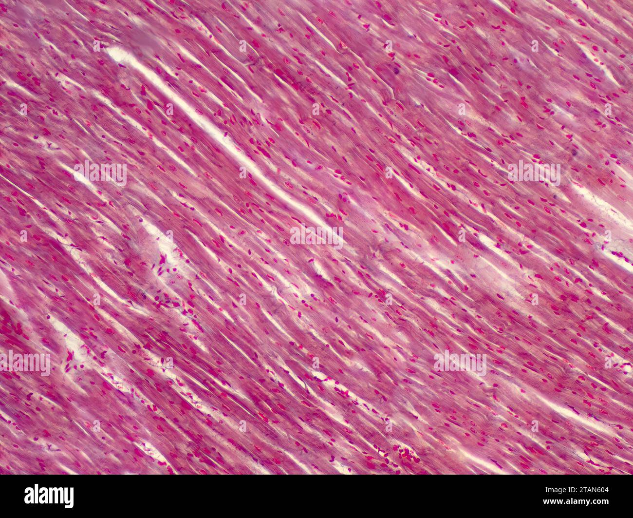 Muscolo cardiaco umano, micrografia leggera Foto Stock