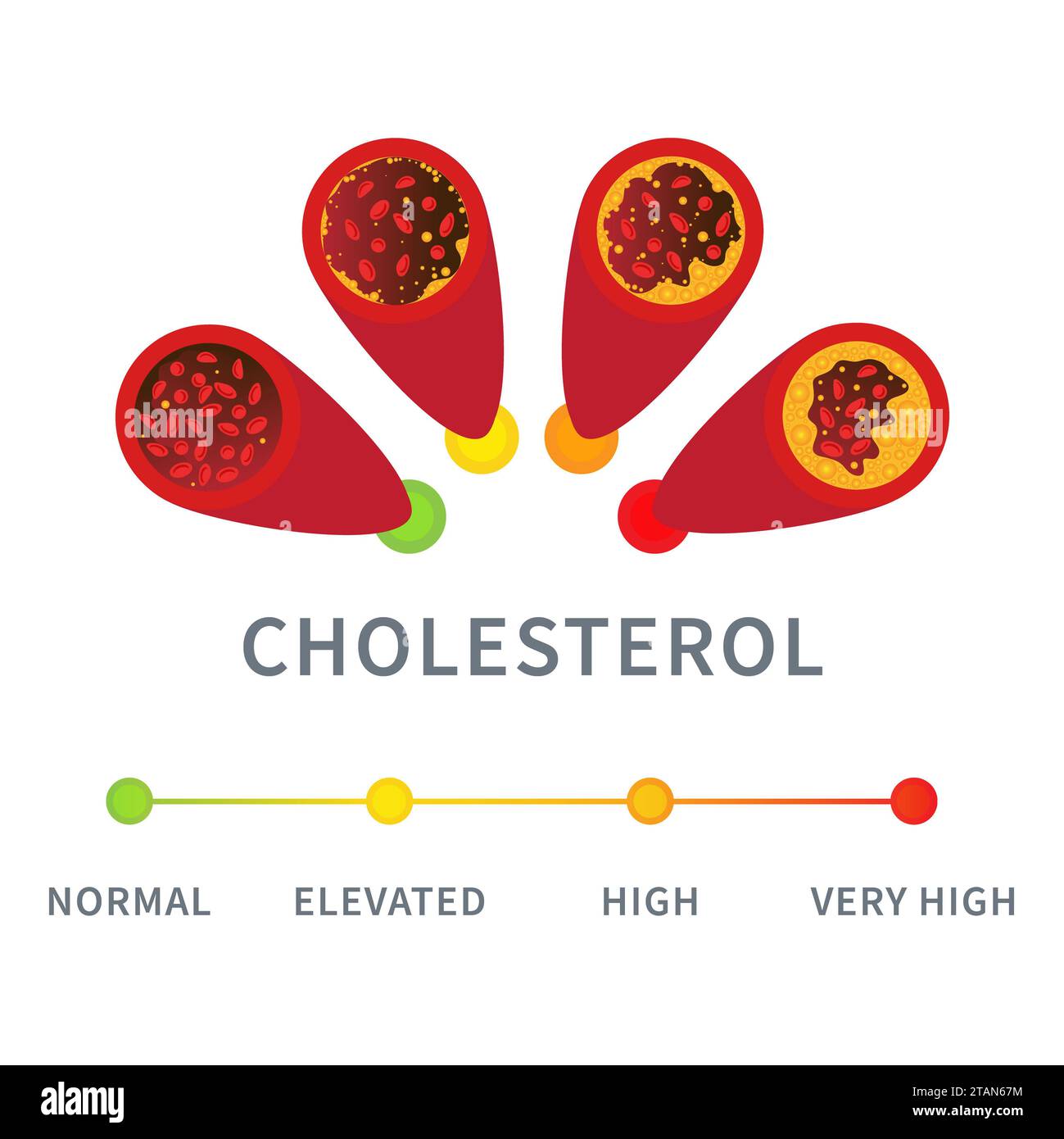 Livelli di colesterolo, illustrazione concettuale. Foto Stock
