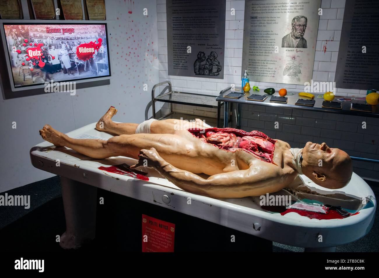Mostra sulla storia delle autopsie al museo "Sick to Death" di Chester, Cheshire Foto Stock