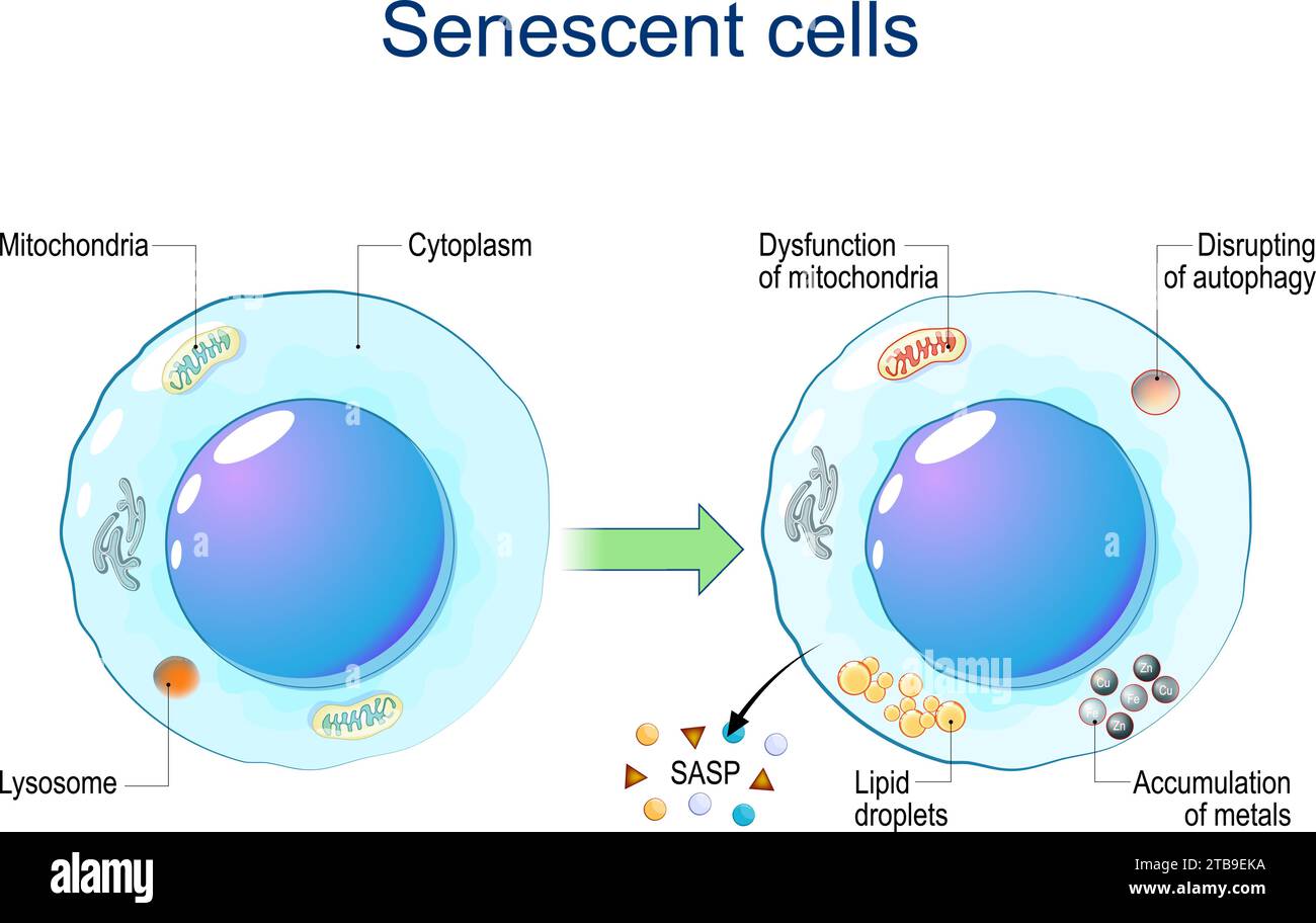 Cellule senescenti. Senescenza cellulare da disfunzione dei mitocondri, accumulo di metalli, interruzione dell'autofagia, rilascio di goccioline lipidiche Illustrazione Vettoriale