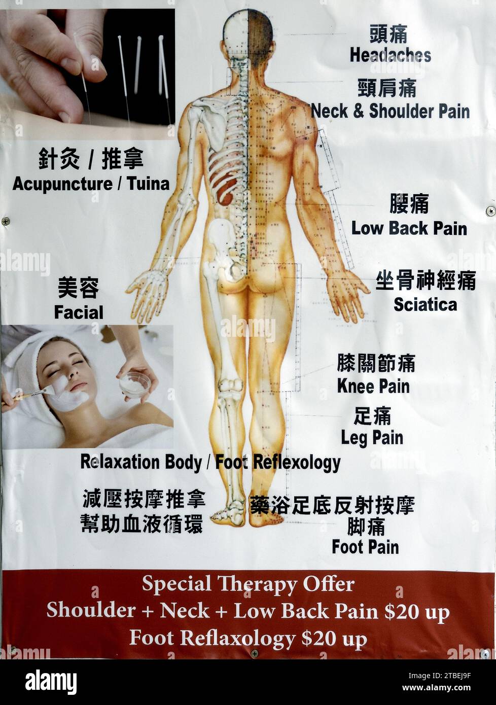 Poster in acapuncture cinese Chinatown, San Francisco, California, Stati Uniti Foto Stock