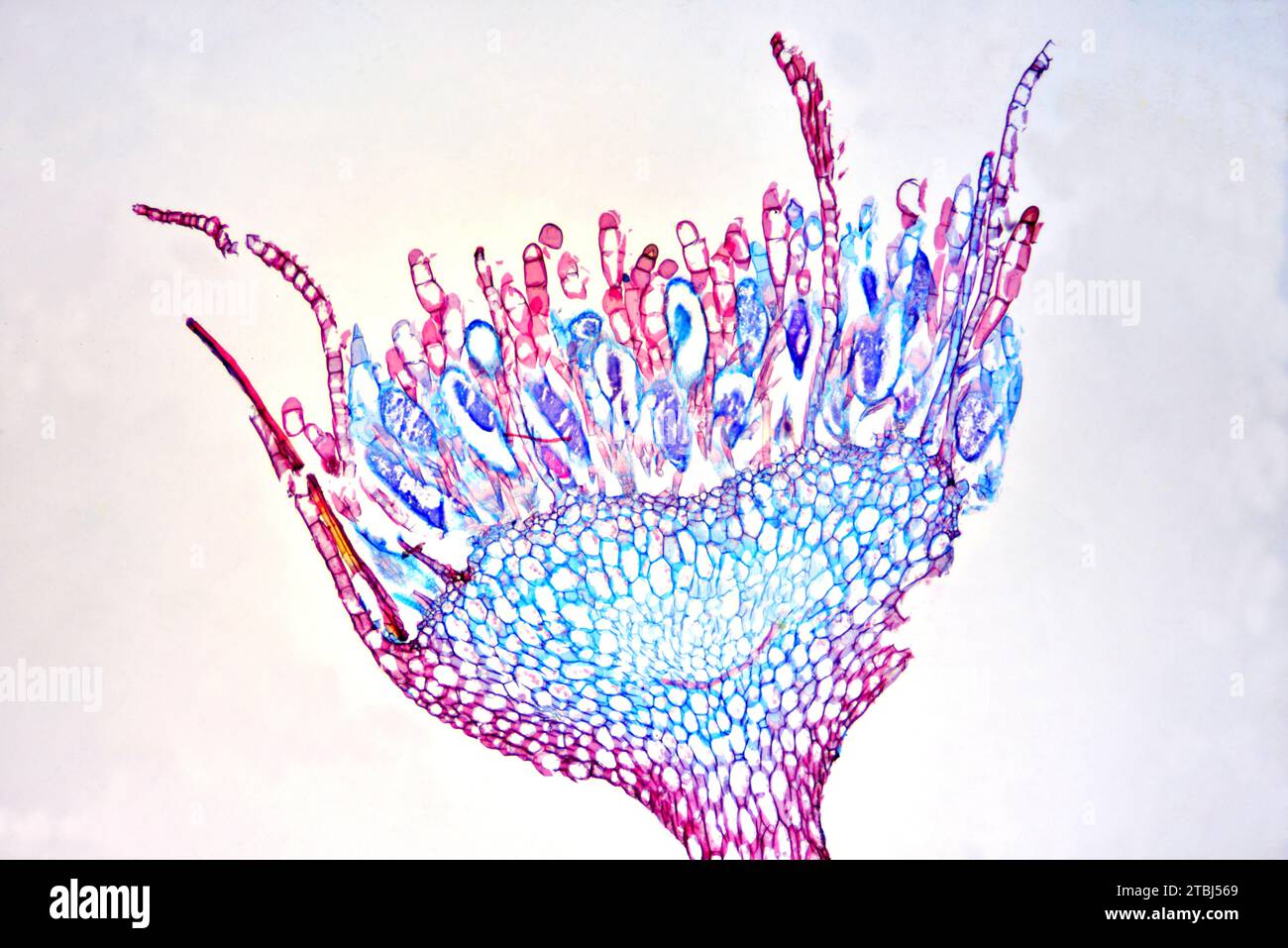 Antheridium of Mnium sp. Microscopio ottico X40. Foto Stock