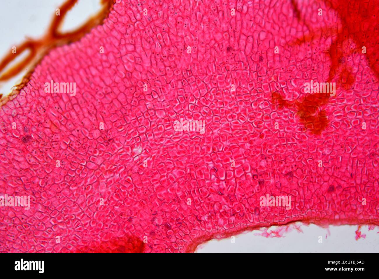 Parenchima Amilifero. Microscopio ottico X100. Foto Stock