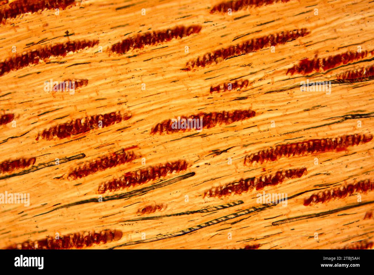 Parenchima legnoso. Microscopio ottico X100. Foto Stock