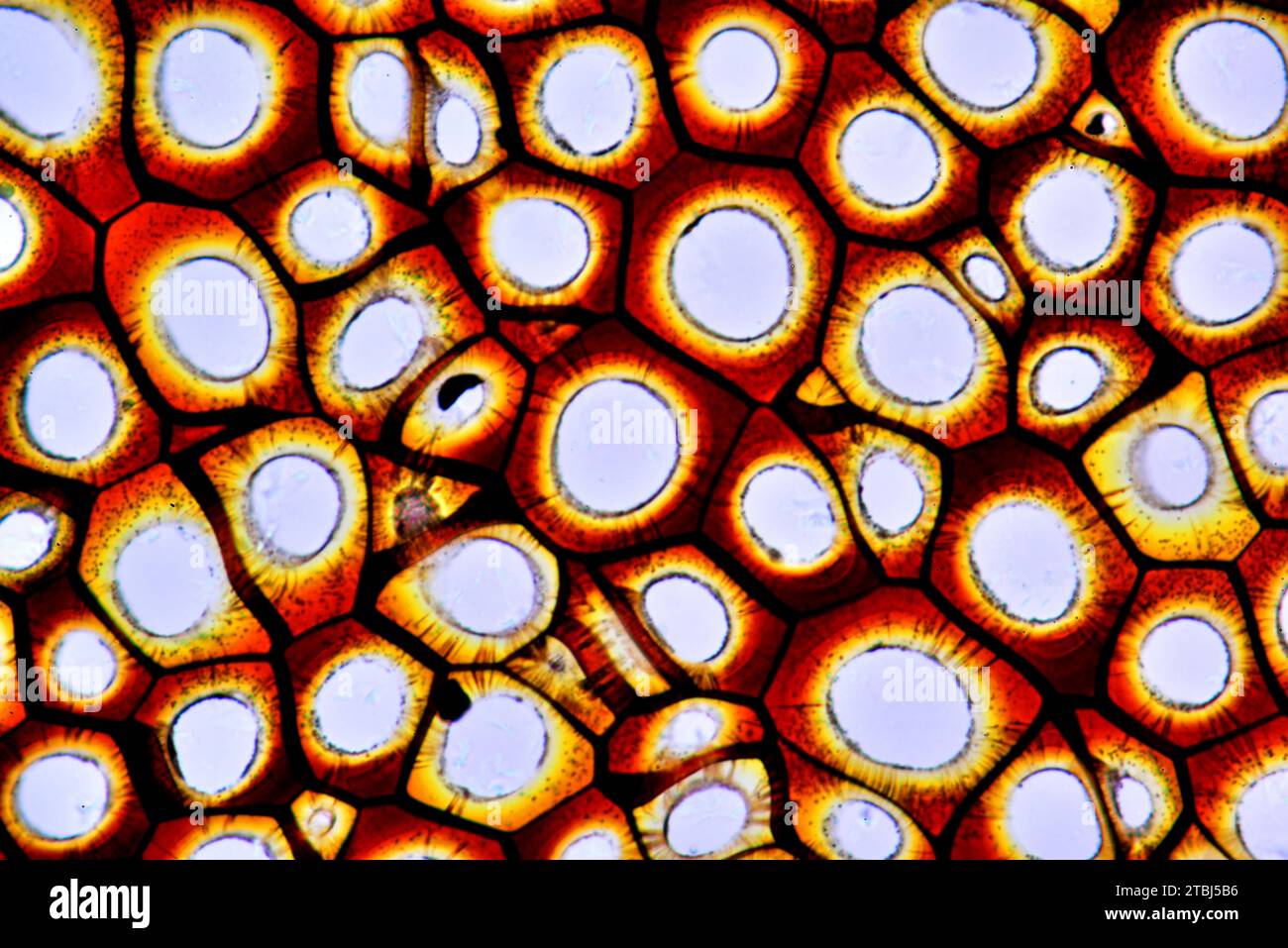 Plammodesmata. Microscopio ottico X400. Foto Stock