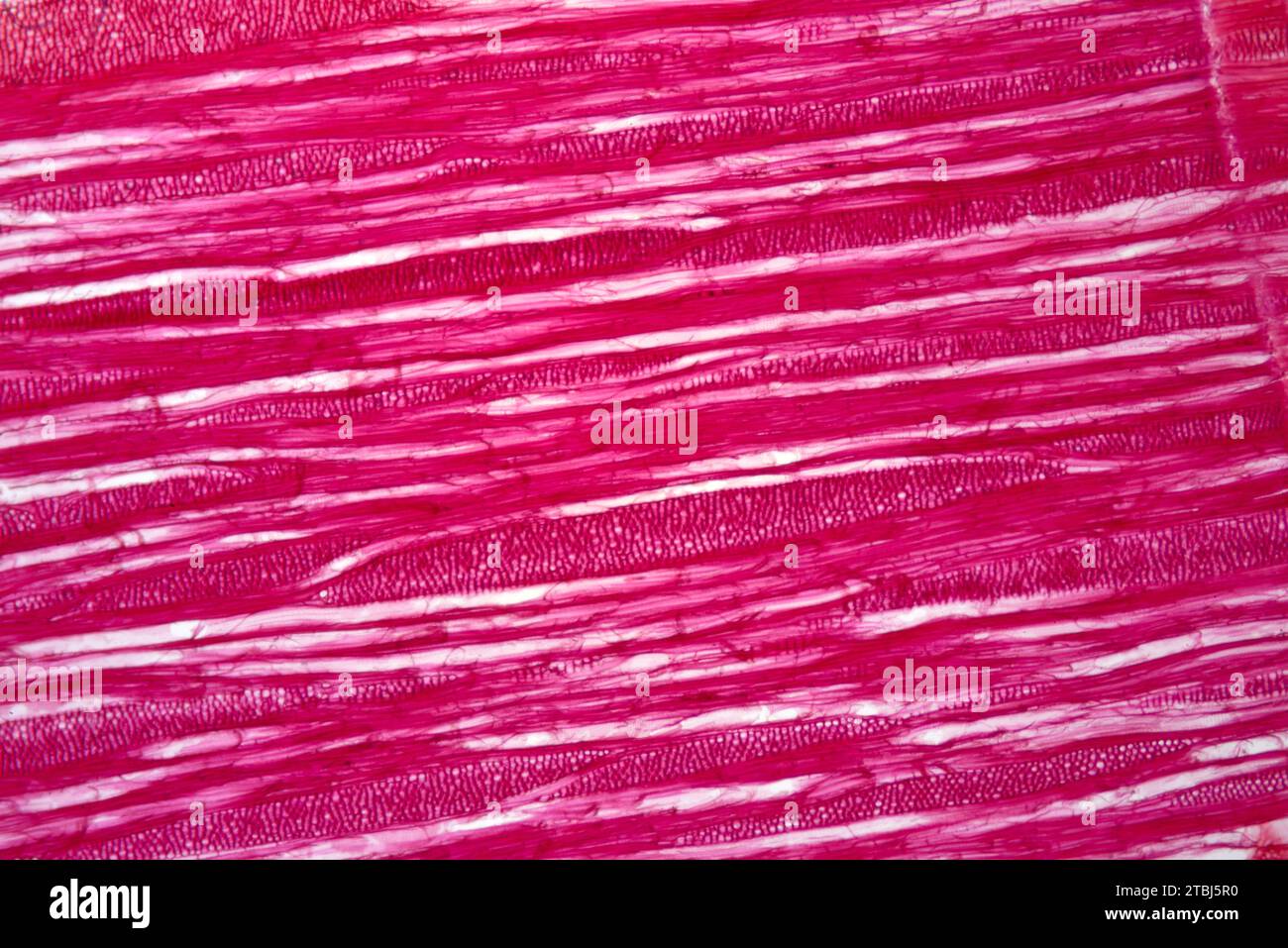 Tracheidi, una sorta di xilema. Microscopio ottico X40. Foto Stock