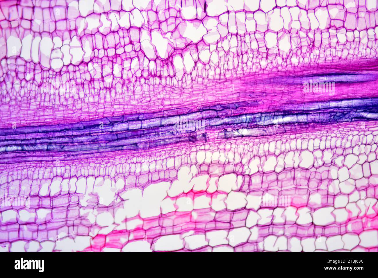 Xylem (Bryonia sp.). Microscopio ottico X40. Foto Stock