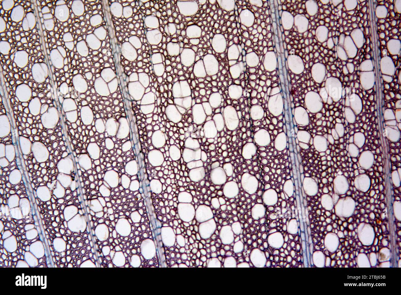Sezione trasversale del tronco con xilema. Microscopio ottico X100. Foto Stock