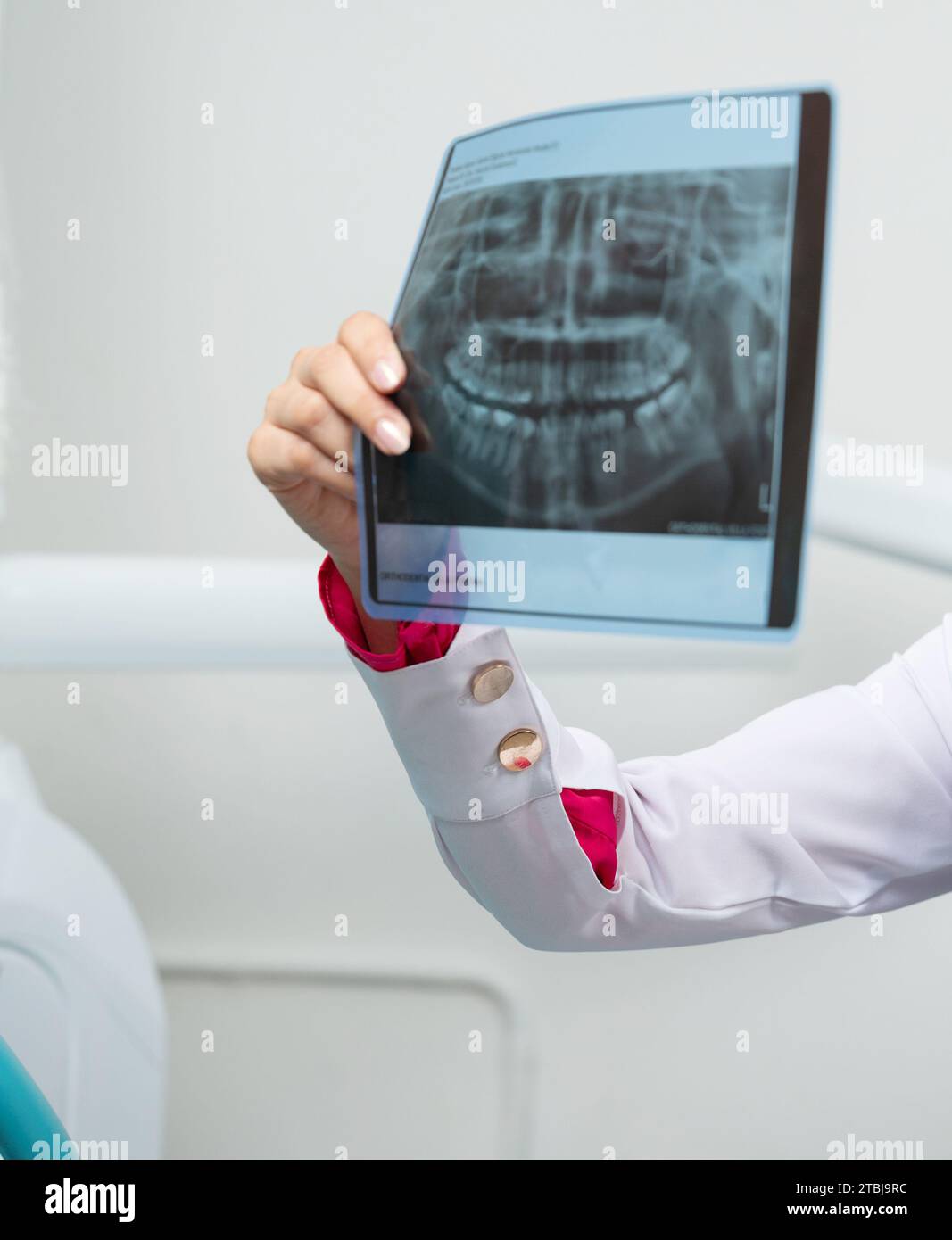 Foto a raggi X di denti umani in mano al medico vista ravvicinata Foto Stock