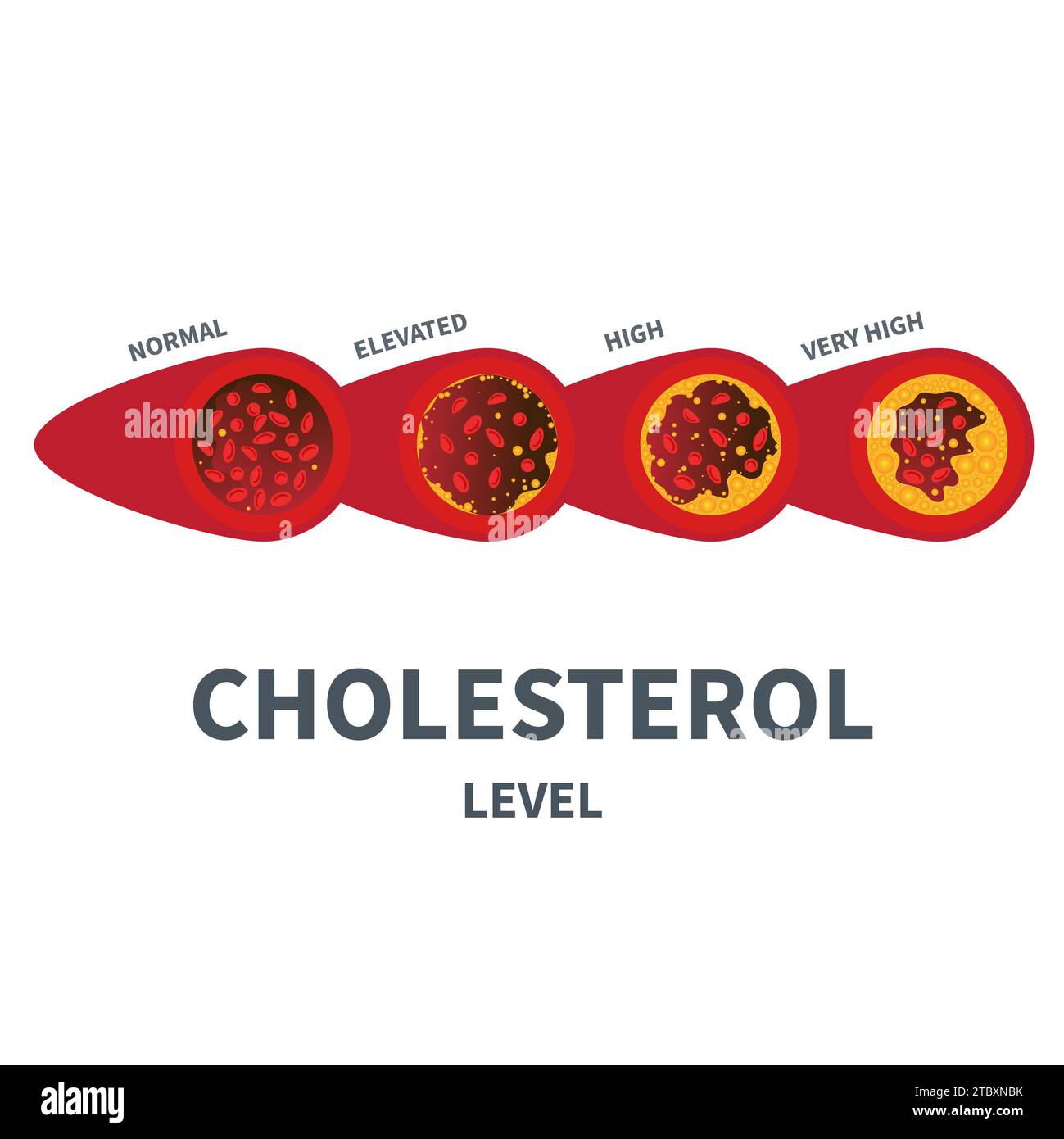 Colesterolo, illustrazione concettuale. Foto Stock