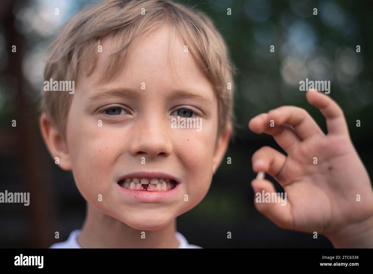 il bambino di 6 anni mostra il dente del latte rotto Foto Stock