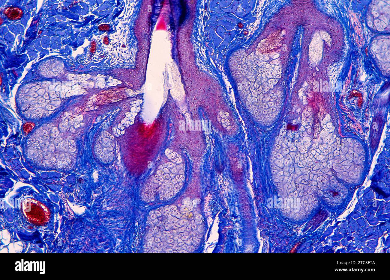 Pelle umana che mostra ghiandole sebacee. Sezione longitudinale. Microscopio ottico, ingrandimento X100. Foto Stock