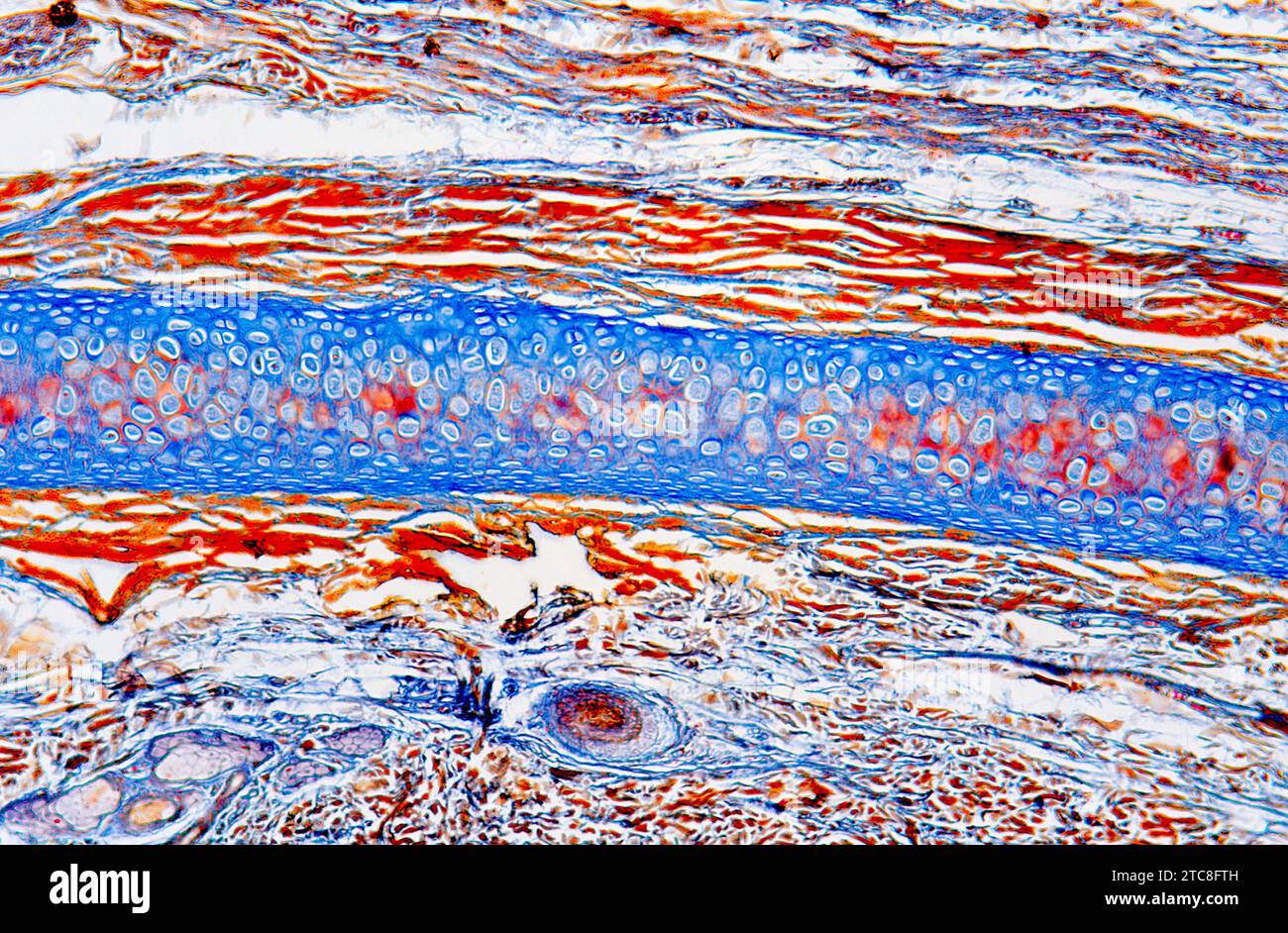 Sezione dell'orecchio che mostra il tessuto cartilagineo elastico con condrociti. Microscopio ottico, ingrandimento X40.. Foto Stock