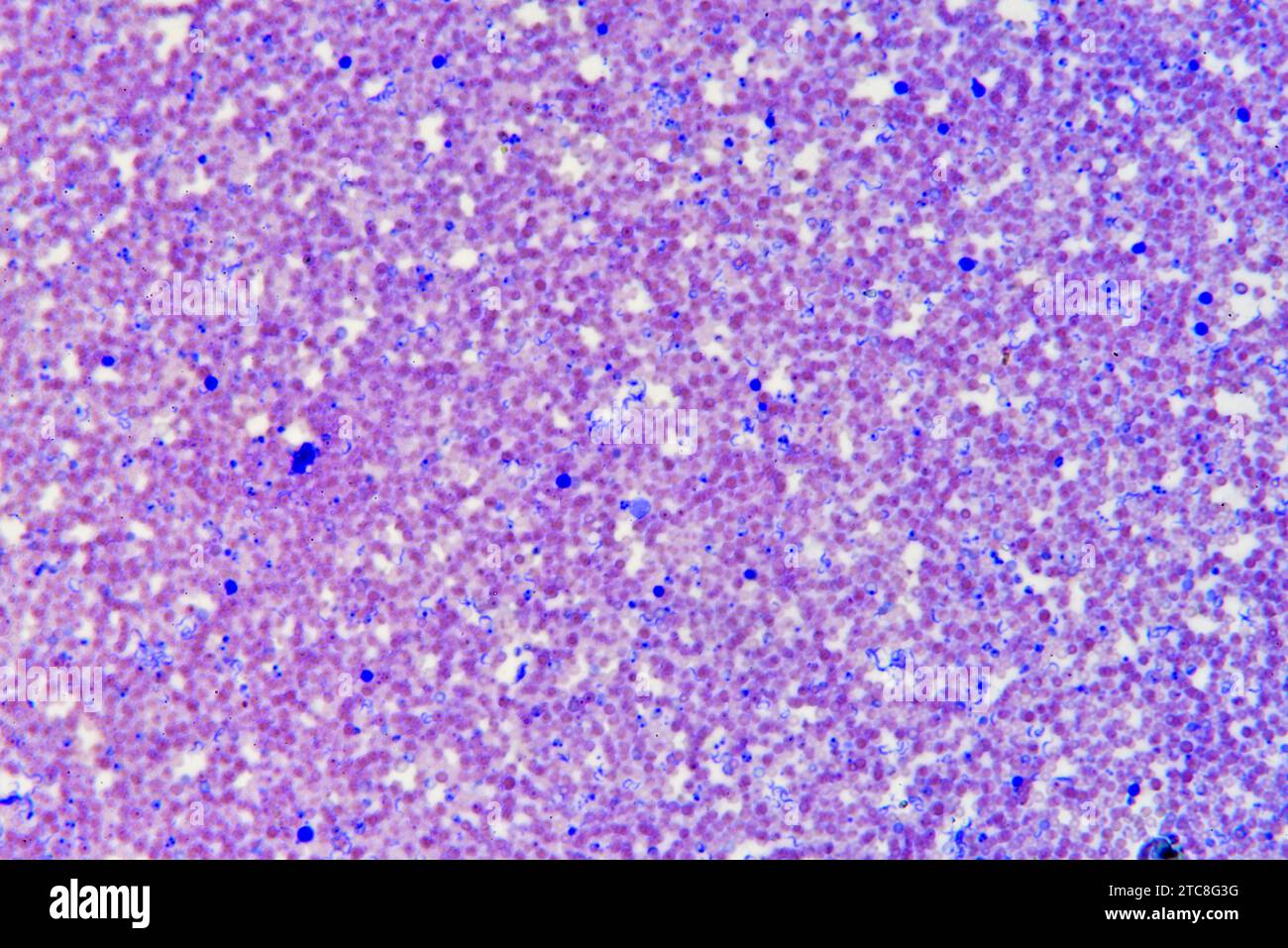 Trypanosoma brucei gambiense nel sangue. Microscopio ottico X200. Foto Stock