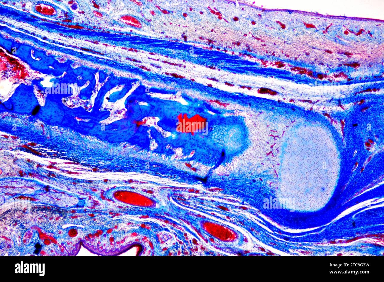 Tessuto connettivo, transizione della cartilagine all'osso nel feto umano. Microscopio leggero X40 con larghezza di 10 cm. Foto Stock