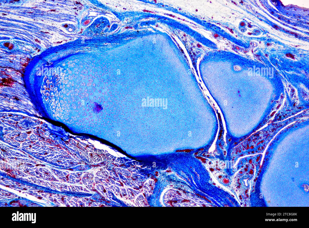 Tessuto connettivo, transizione della cartilagine all'osso nel feto umano. Microscopio leggero X40 con larghezza di 10 cm. Foto Stock