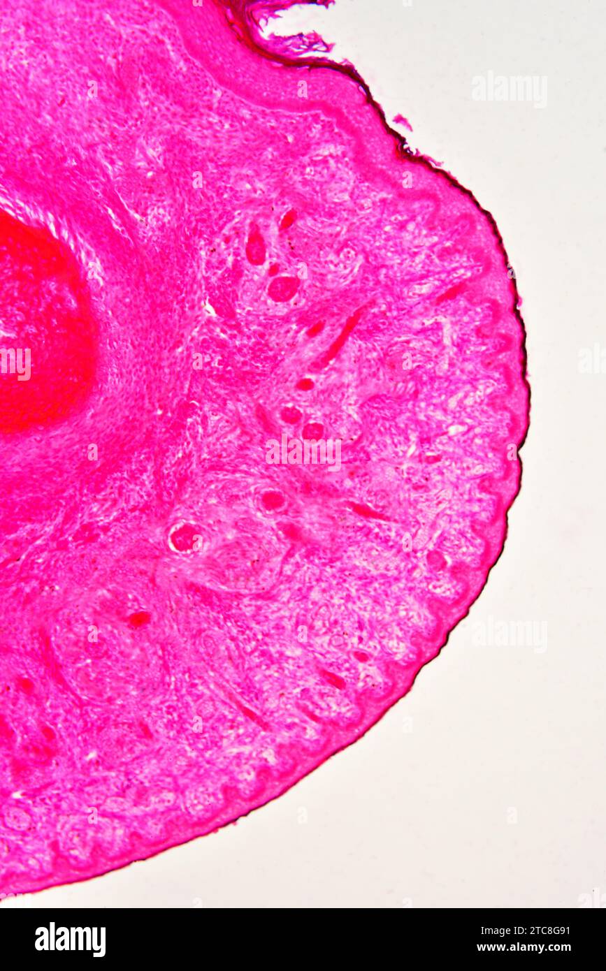Epitelio del dito del feto umano. Microscopio leggero X100. Foto Stock