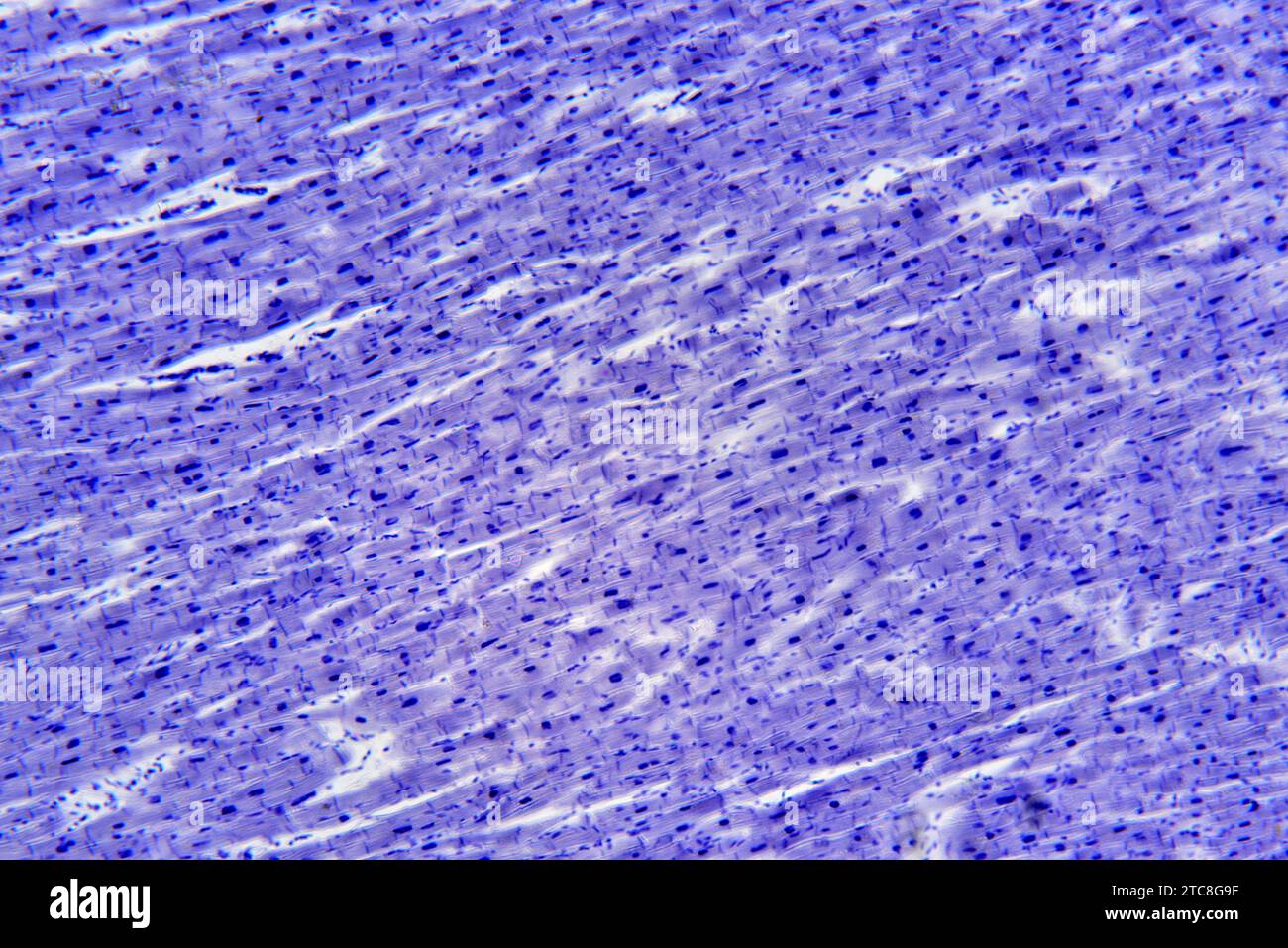 Muscolo cardiaco che mostra miociti. Microscopio leggero X150 con larghezza di 10 cm. Foto Stock