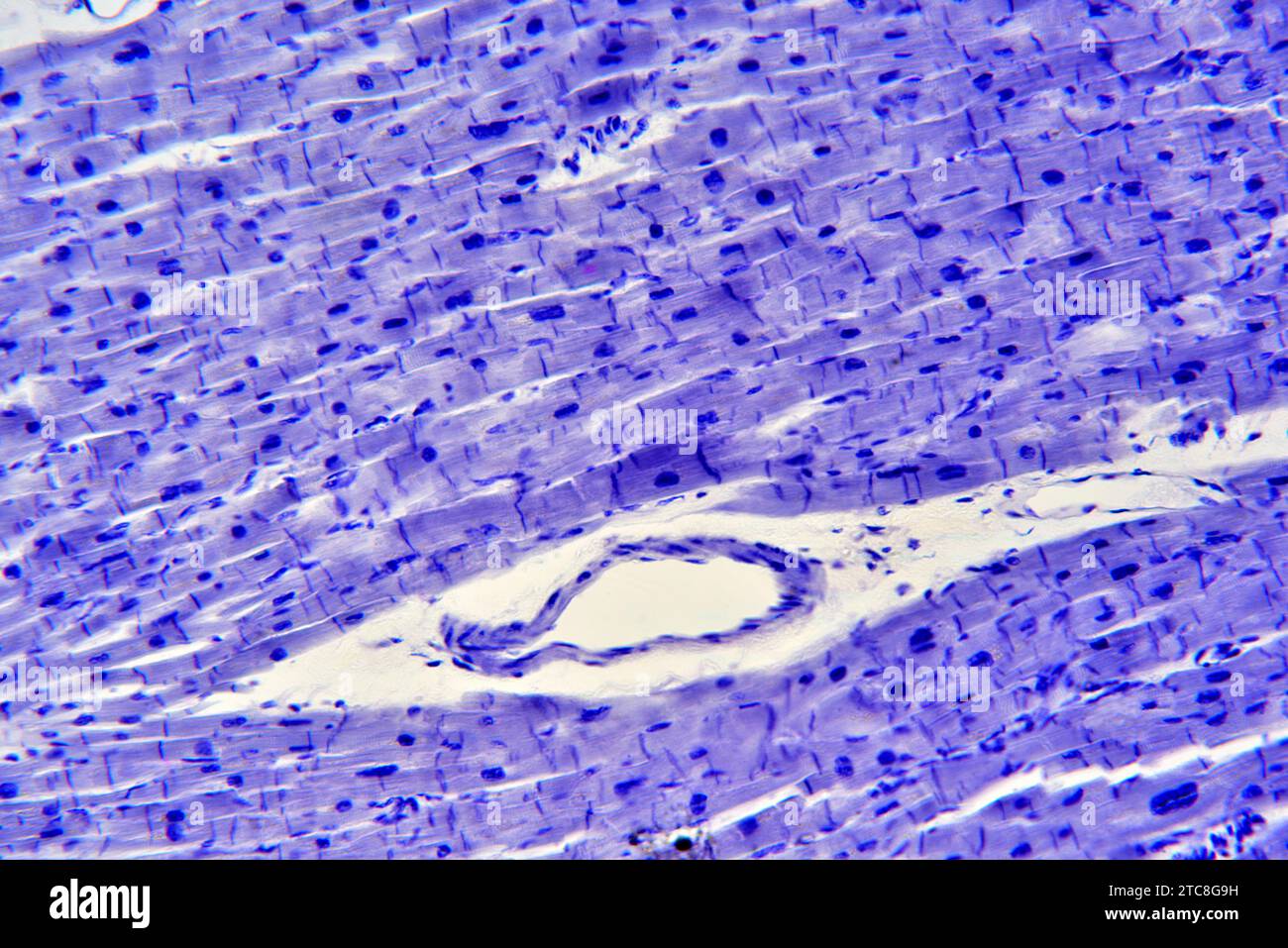 Muscolo cardiaco che mostra miociti. Microscopio leggero X300 con larghezza di 10 cm. Foto Stock