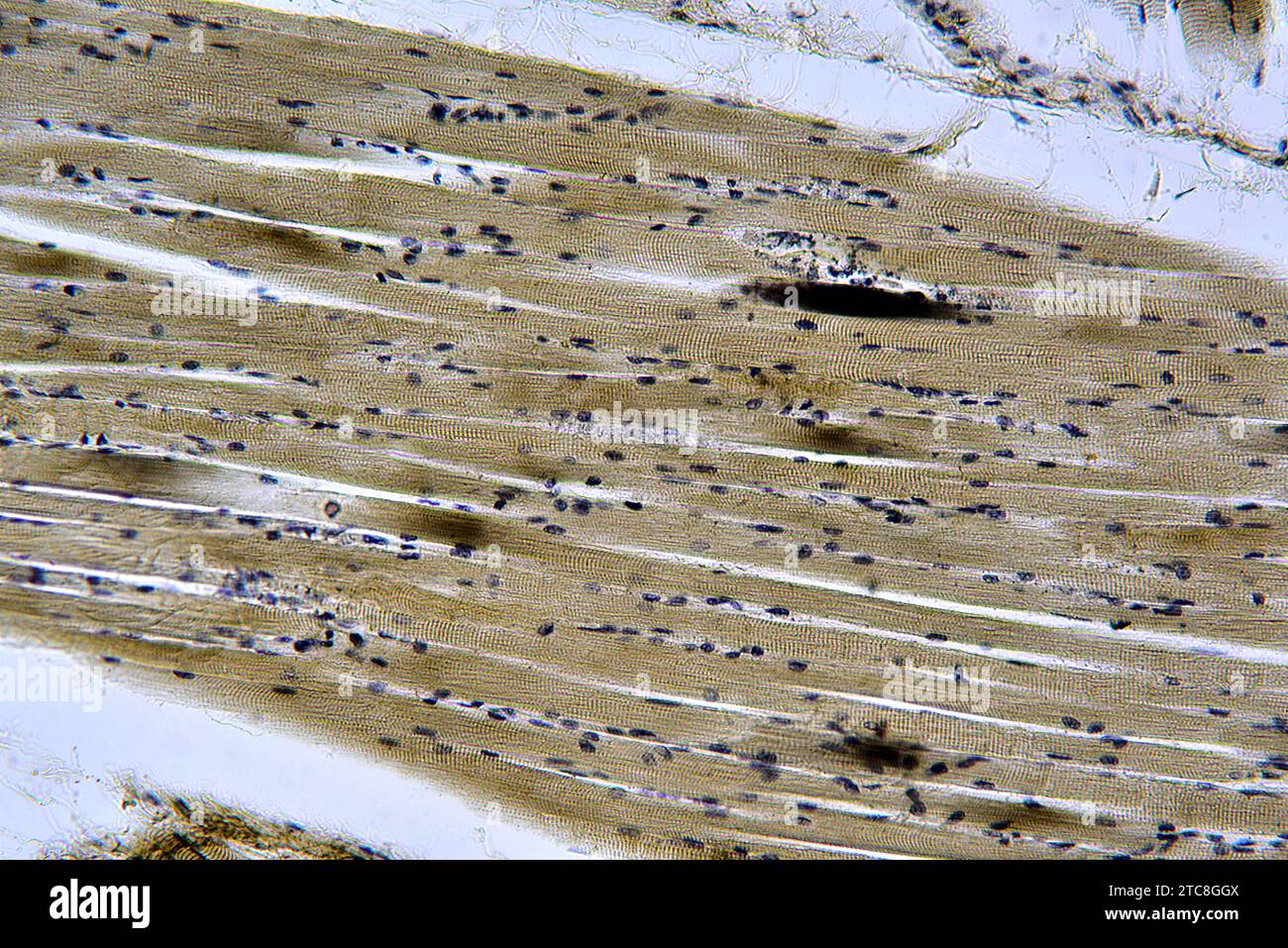 Muscolo scheletrico umano in sezione longitudinale. Microscopio leggero X300 con larghezza di 10 cm. Foto Stock