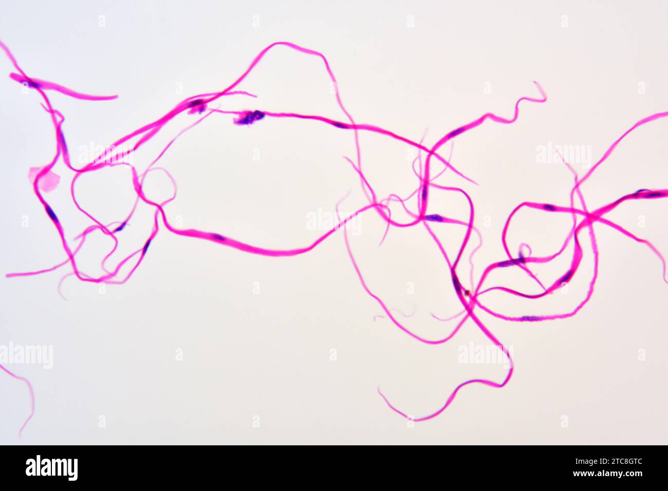 Muscolo liscio (miociti). Microscopio leggero X300 con larghezza di 10 cm. Foto Stock