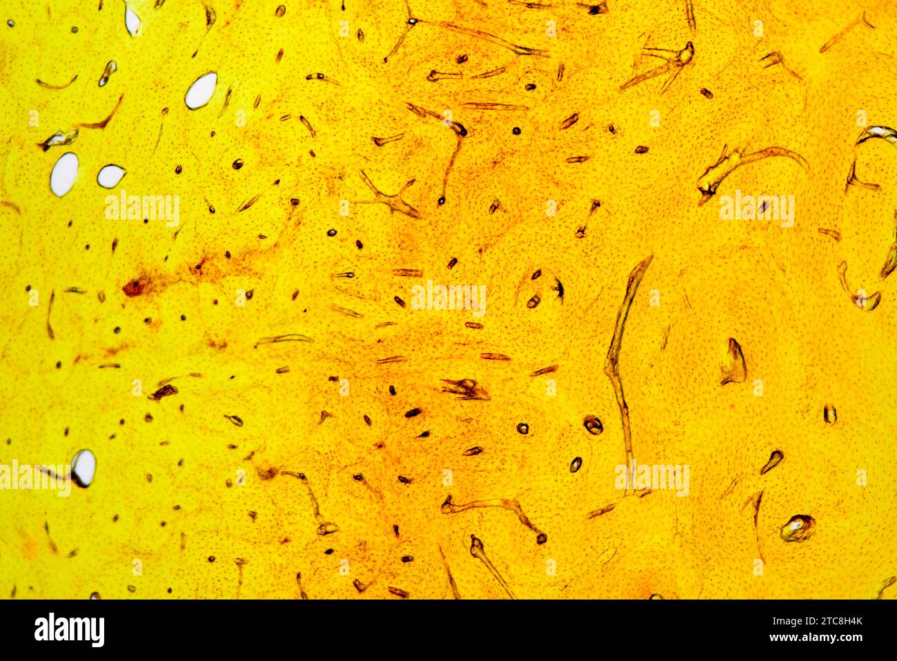 Tessuto osseo corticale che mostra canali haversiani, osteoni, osteociti e matrice minerale. Microscopio leggero X40 con larghezza di 10 cm. Foto Stock