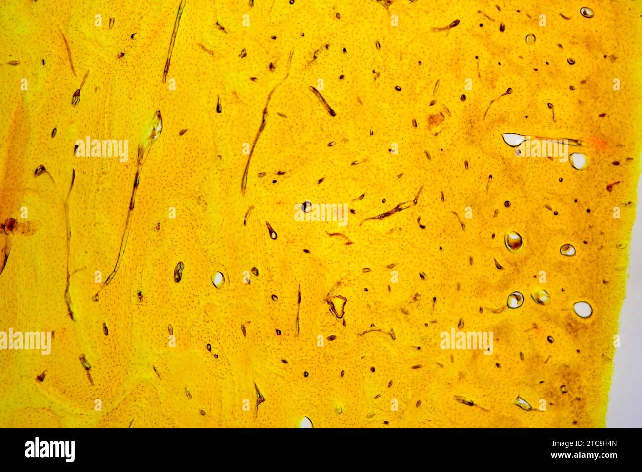 Tessuto osseo corticale che mostra canali haversiani, osteoni, osteociti e matrice minerale. Microscopio leggero X40. a 10 cm di larghezza Foto Stock