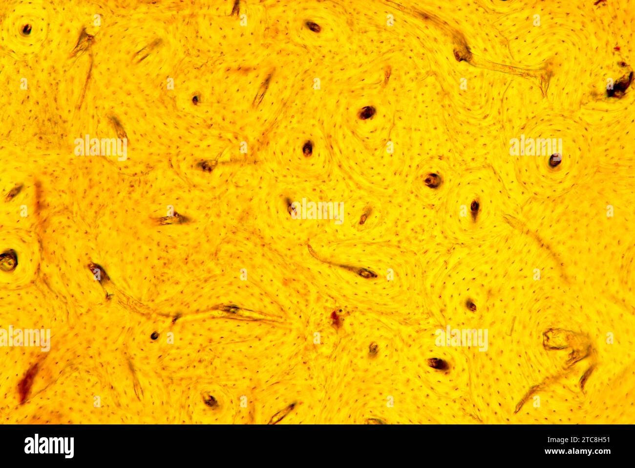 Tessuto osseo corticale che mostra canali haversiani, osteoni, osteociti e matrice minerale. Microscopio leggero X150 con larghezza di 10 cm. Foto Stock