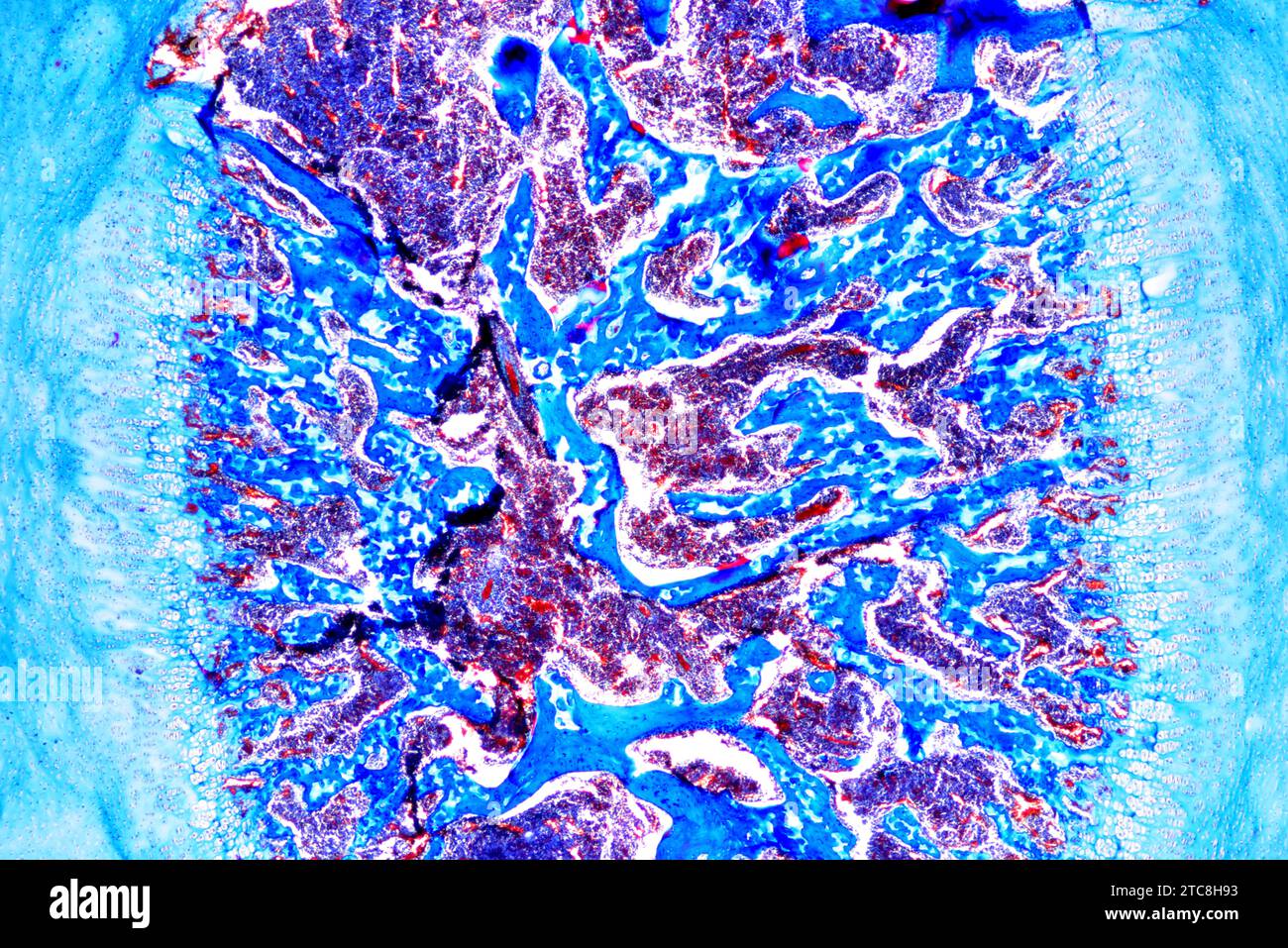 L'osso cancelloso o spugnoso è un organo ematopoietico. Microscopio leggero X40 con larghezza di 10 cm. Foto Stock