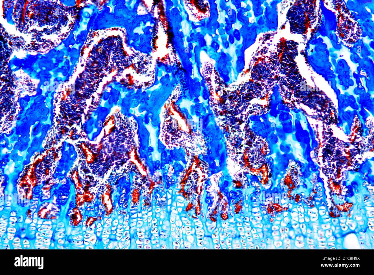 L'osso cancelloso o spugnoso è un organo ematopoietico. Microscopio leggero X150 con larghezza di 10 cm. Foto Stock