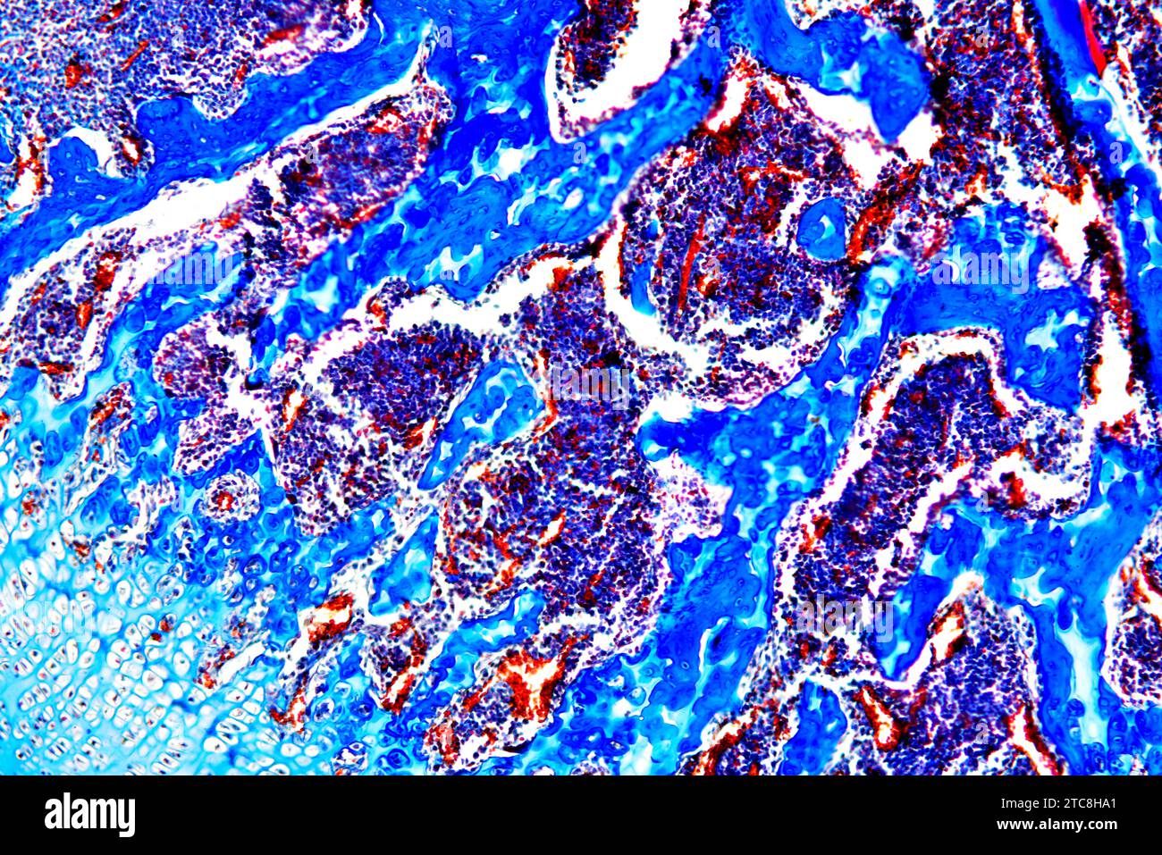 L'osso cancelloso o spugnoso è un organo ematopoietico. Microscopio leggero X150 con larghezza di 10 cm. Foto Stock