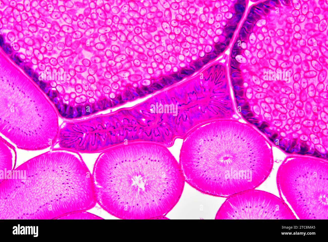 Ascaris lumbricoides femmine che mostrano intestino, ovaie e utero con uova. Microscopio leggero X150 con larghezza di 10 cm. Foto Stock