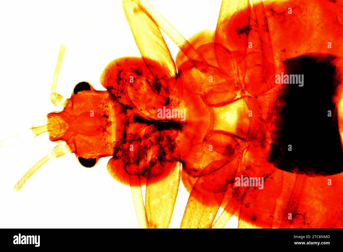 La cimice comune (Cimex lectularius) è un insetto parassita che si nutre esclusivamente di sangue umano. È un vettore di malattia. Microscopio leggero X50 a 10 cm di larghezza Foto Stock