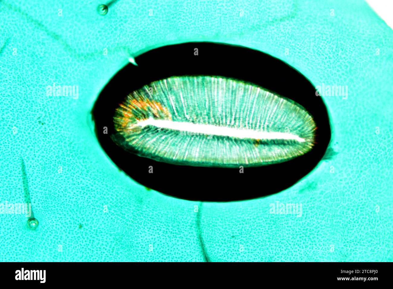 Spiracolo di insetti. Microscopio leggero X150 con larghezza di 10 cm. Foto Stock