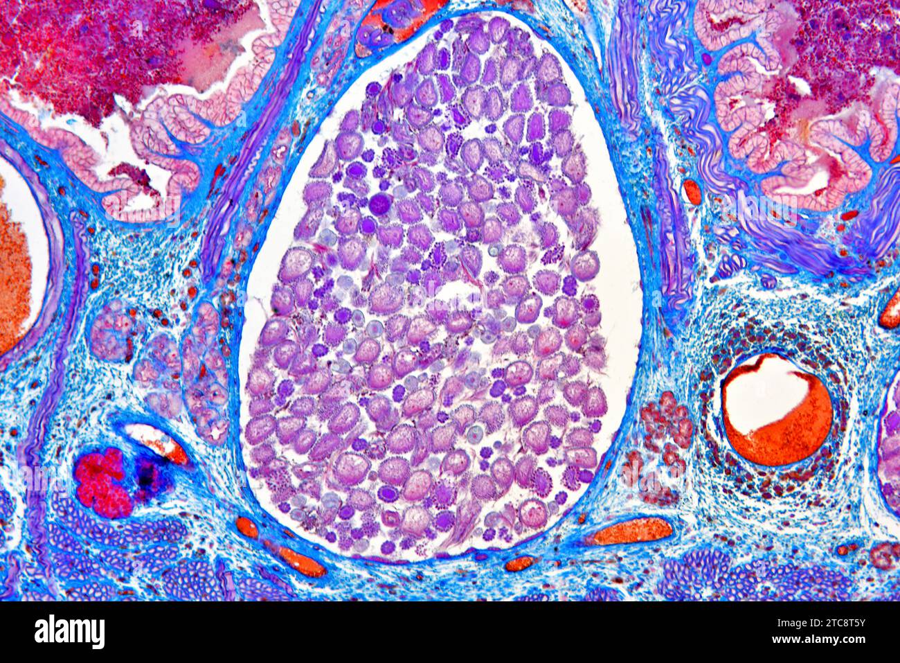 Sezione trasversale del leech medicinale europeo (Hirudo medicinalis) che mostra diverticolo dell'utero e dell'intestino e delle colture. Microscopio leggero X150 con larghezza di 10 cm. Foto Stock