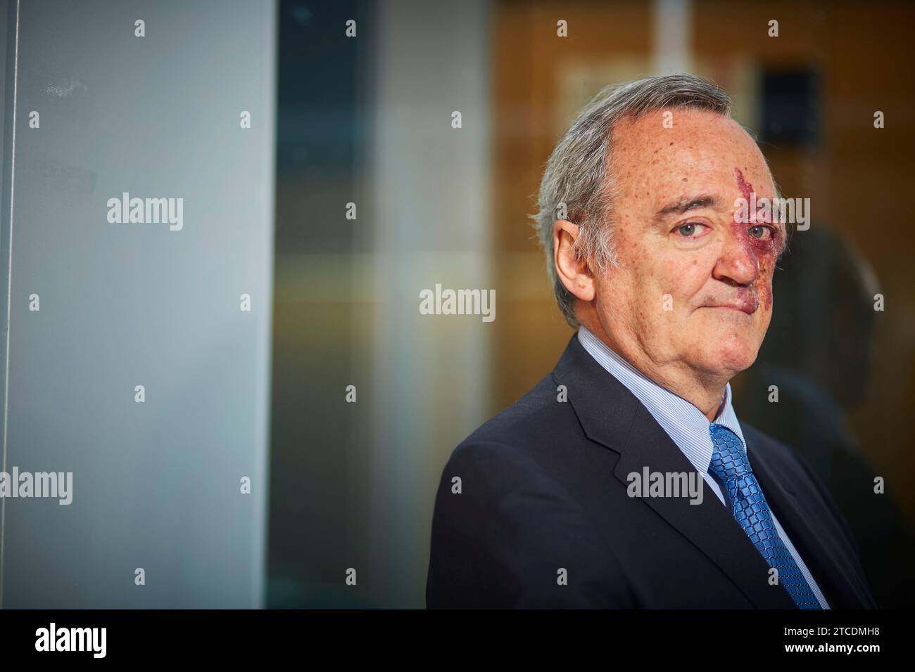 Madrid, 25/05/2018. Navarra University Clinic. Intervista a Mariano Barbacid, biochimico specializzato in trattamenti oncologici. Foto: Guillermo Navarro. ARCHDC. Crediti: Album / Archivo ABC / Guillermo Navarro Foto Stock