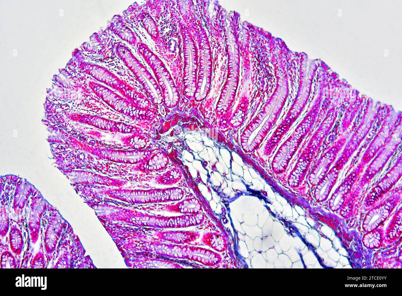 Colon umano che mostra epitelio, mucosa, sottomucosa, tessuto adiposo, ghiandole intestinali e villi. Microscopio ottico X100. Foto Stock