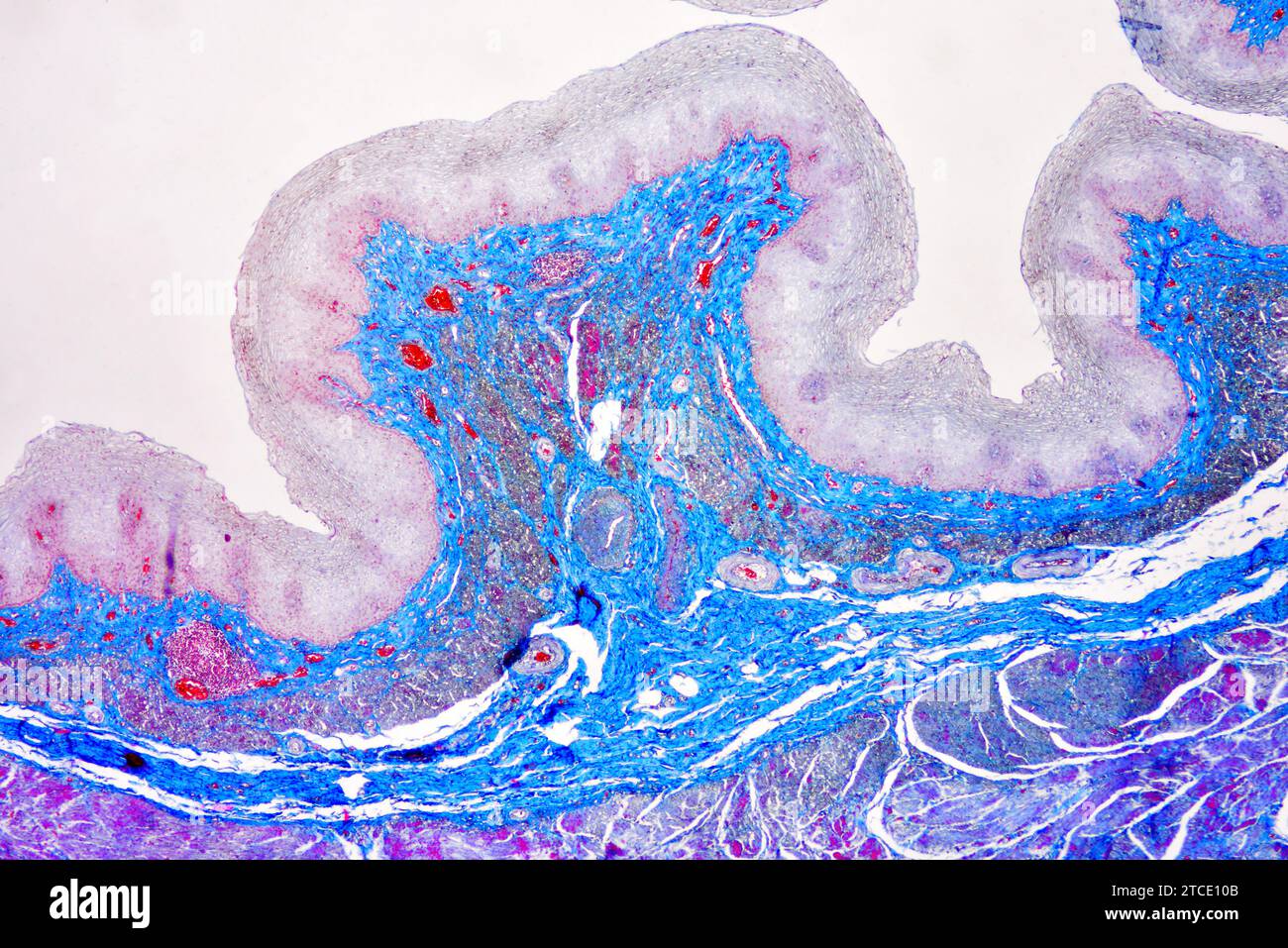 Esofago o esofago umano che mostra epitelio squamoso stratificato. Microscopio ottico X40. Foto Stock