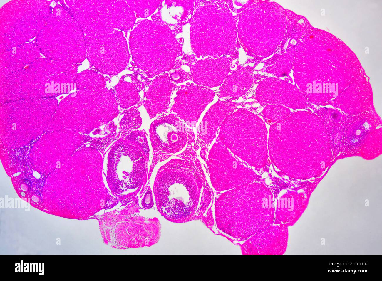 Sezione ovarica che mostra corpus luteum, stroma, epitelio e follicoli. Microscopio ottico X40. Foto Stock