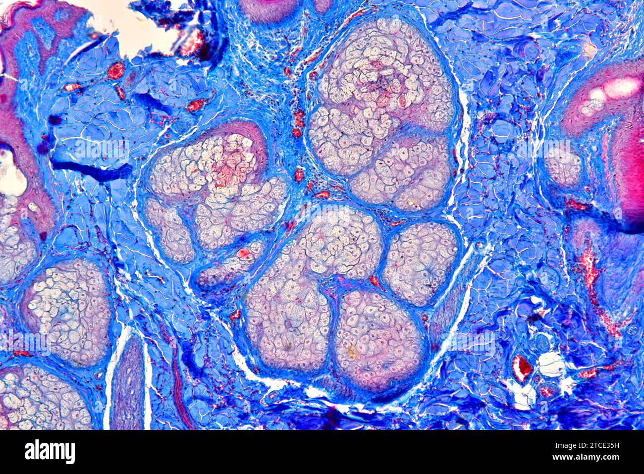 Sezione trasversale del cuoio capelluto umano che mostra ghiandole sebacee e tessuto fibroso. Microscopio ottico X100. Foto Stock