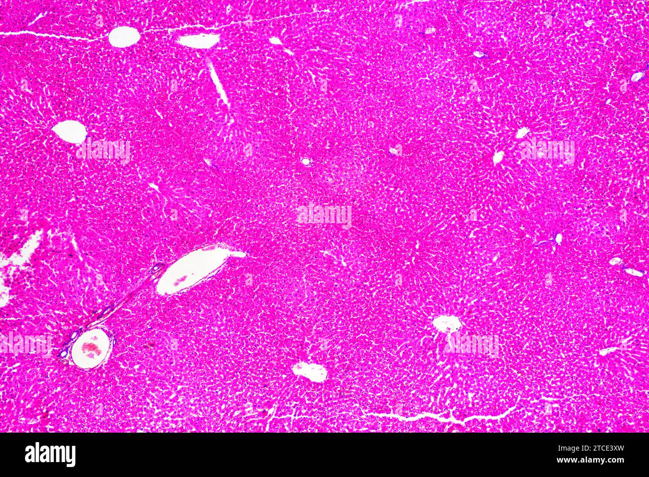 Fegato umano normale con epatociti e vasi sanguigni. Microscopio ottico X40. Foto Stock