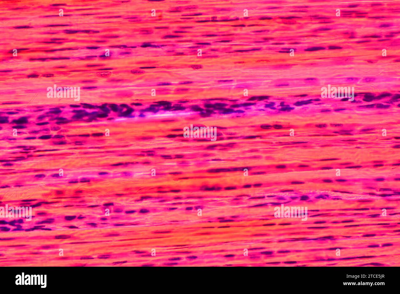 Tessuto connettivo denso o tessuto fibroso che mostra fibroblasti, fibre di collagene e matrice. Microscopio ottico X400. Foto Stock