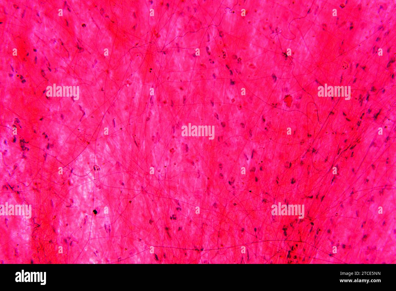 Tessuto connettivo allentato o tessuto reticolare che mostra fibroblasti, fibre di collagene e matrice. Microscopio ottico X200. Foto Stock