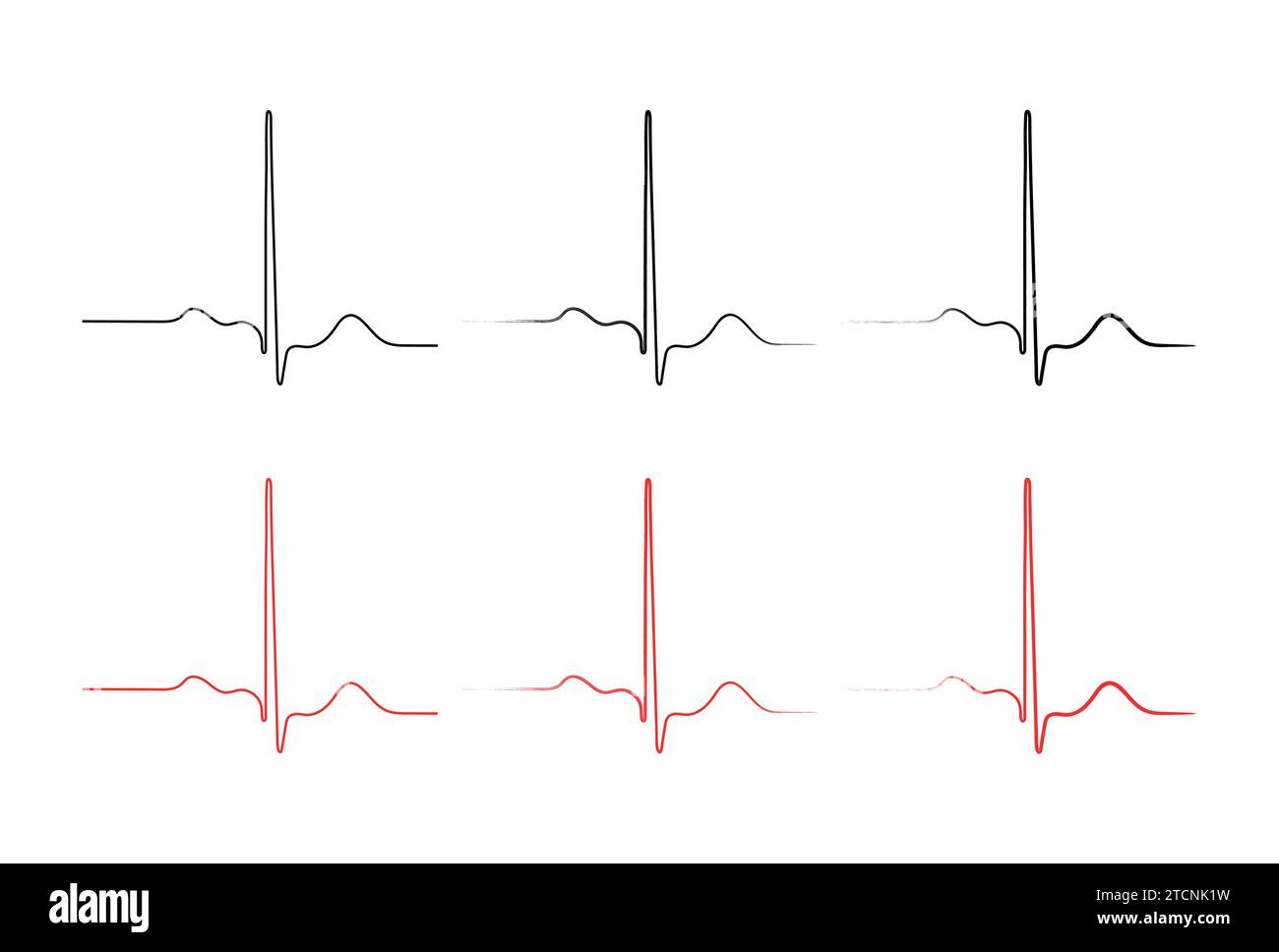 Ripolarizzazione ventricolare, ciclo cardiaco, ECG cardiaco nel ritmo sinusale normale, intervallo QT dell'ECG. Illustrazione Vettoriale
