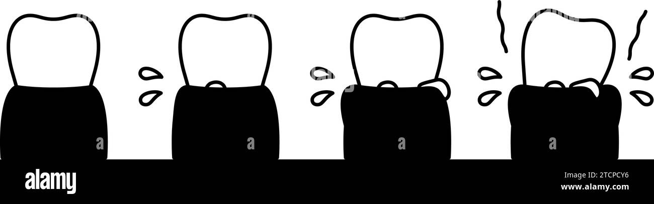 Illustrazione dell'immagine di progressione della malattia parodontale, semplice disegno di linee, illustrazione vettoriale Illustrazione Vettoriale