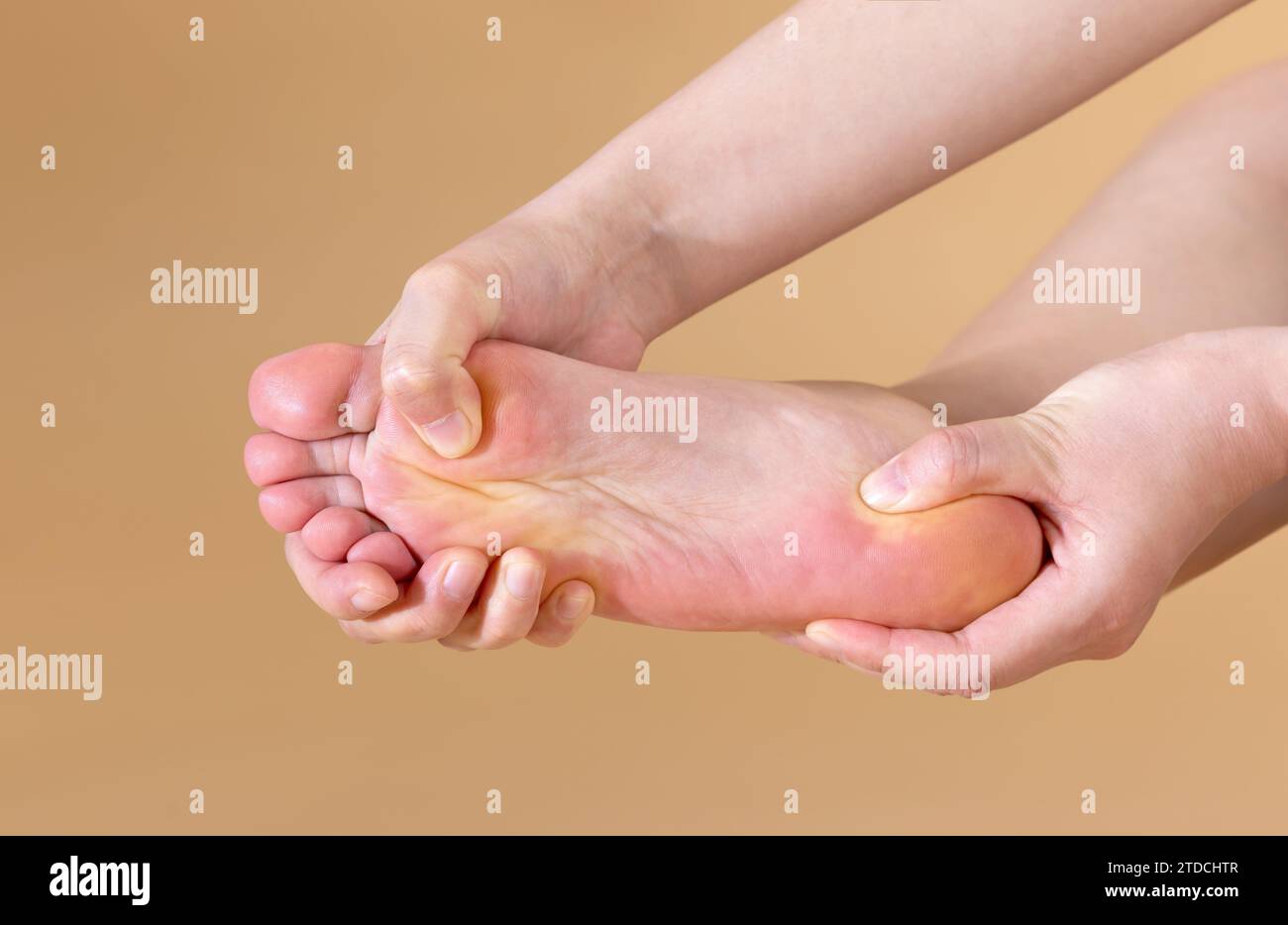 Una donna con un forte dolore plantare sta massaggiando il piede, isolata su sfondo beige Foto Stock